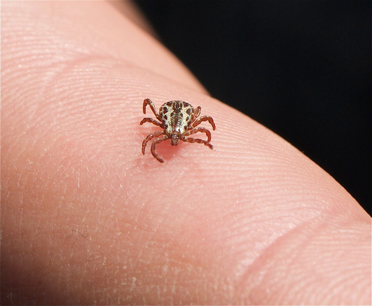 American dog tick on skin